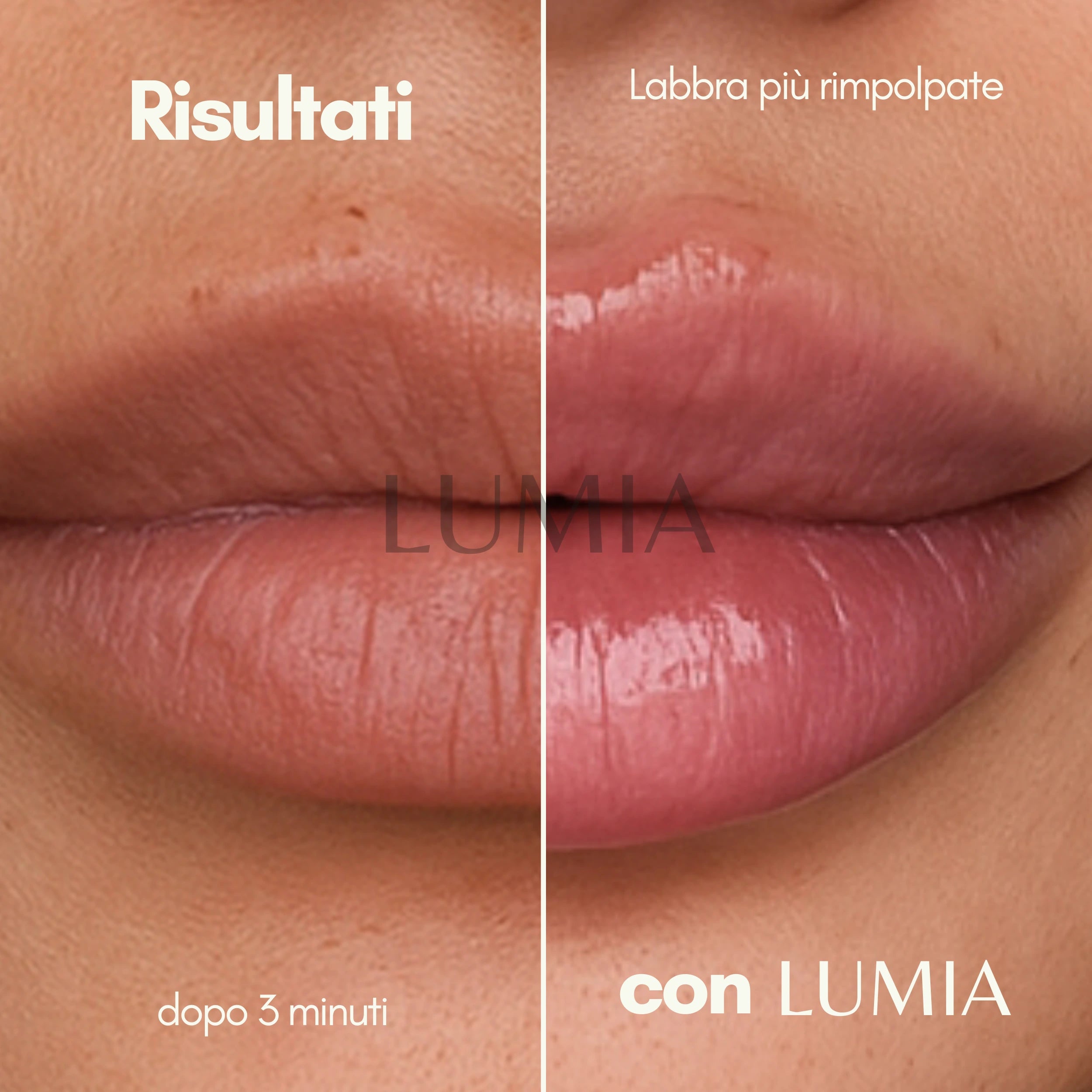 Gloss Volumizzante Labbra - Extreme Formula